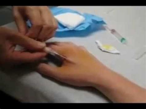 rfid chip procedure obama care 2014|RFID CHIP PROCEDURE! OBAMA CARE 2014 .